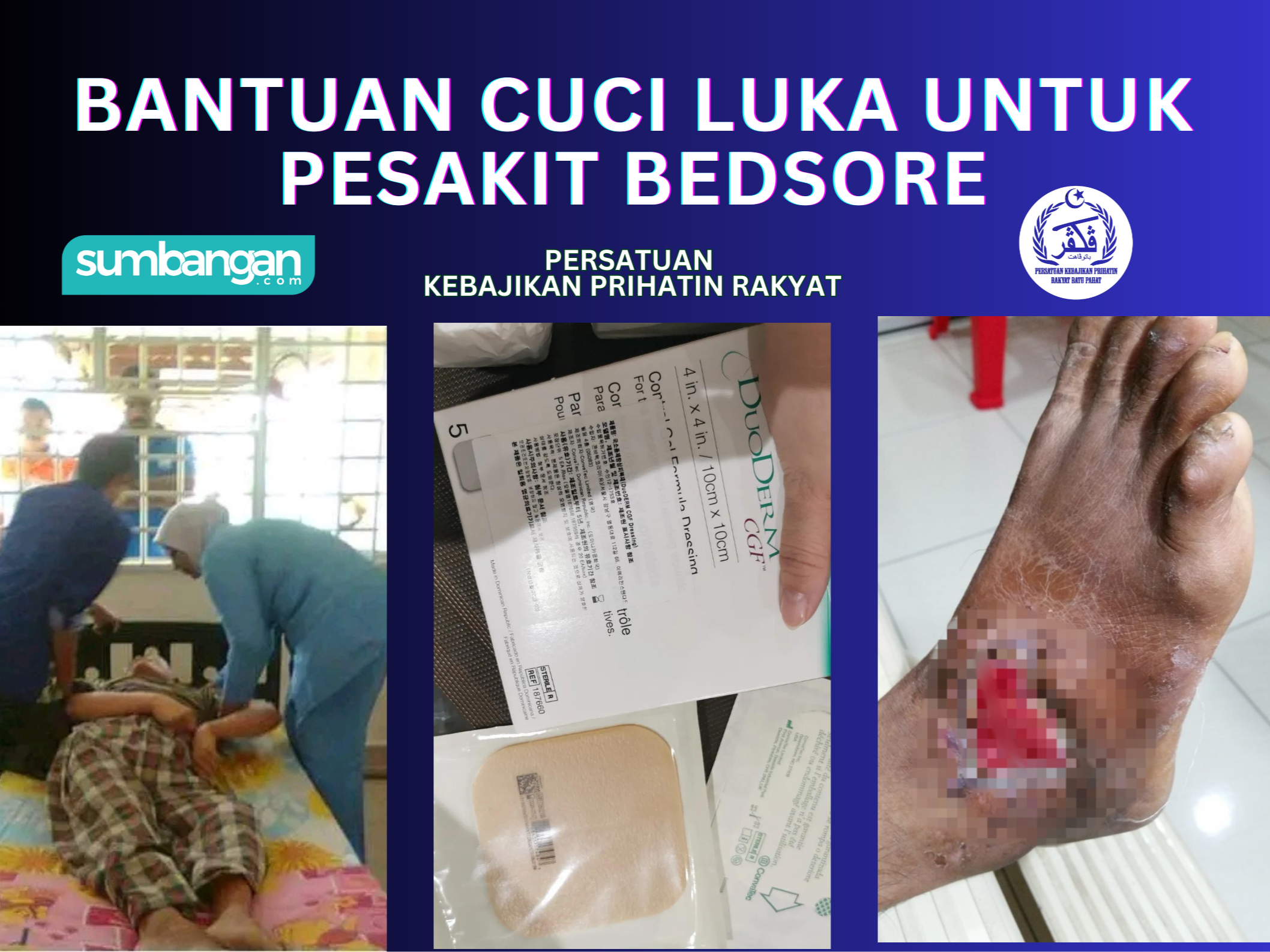 BANTUAN CUCI LUKA UNTUK PESAKIT TEKANAN ULSER