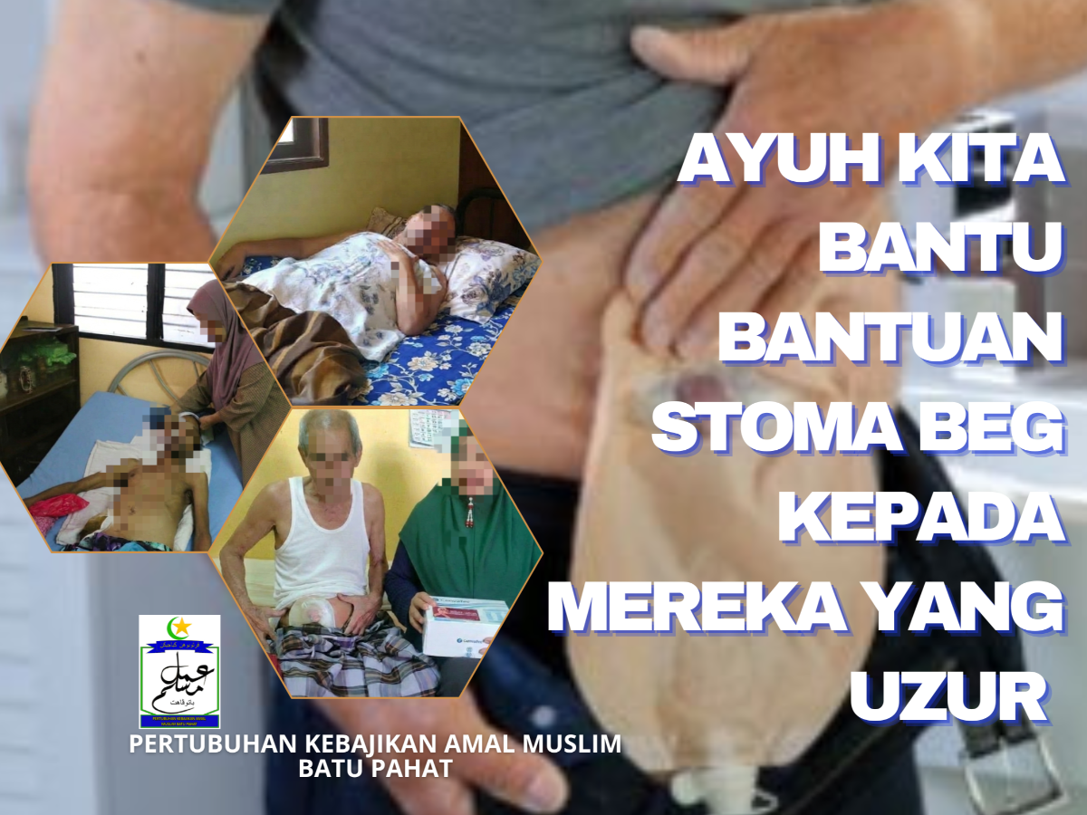 BANTULAH PEMBELIAN STOMA BEG UNTUK PESAKIT YANG UZUR