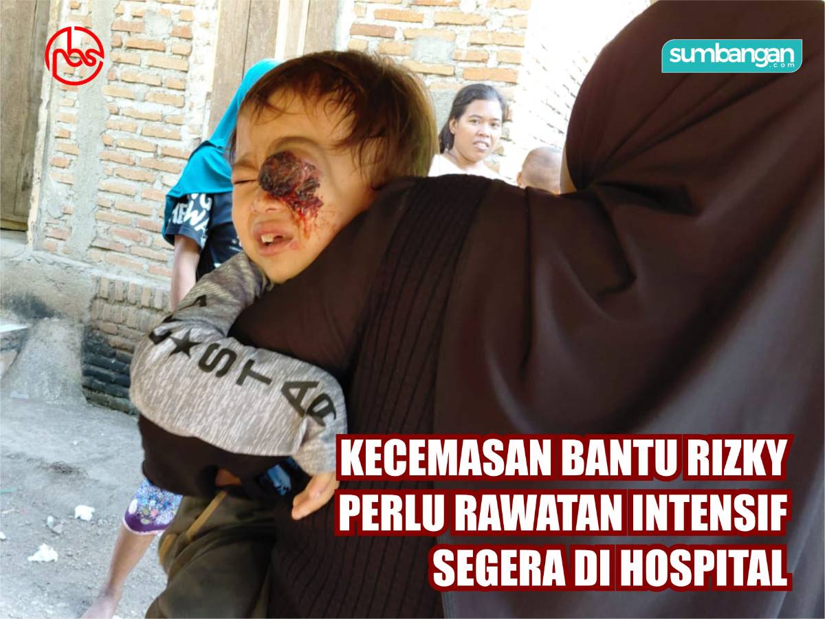 KECEMASAN DERITA TUMOR MATA KIAN MEREBAK DAN PERLU PEMBEDAHAN SEGERA